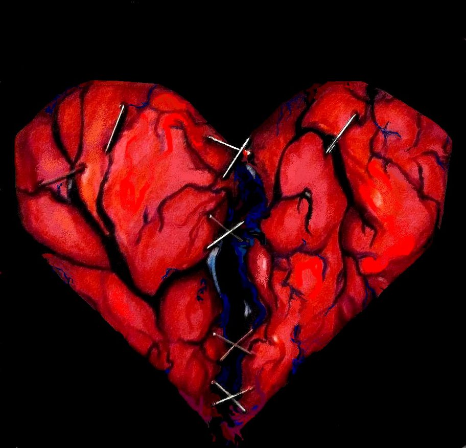 Heart Pain